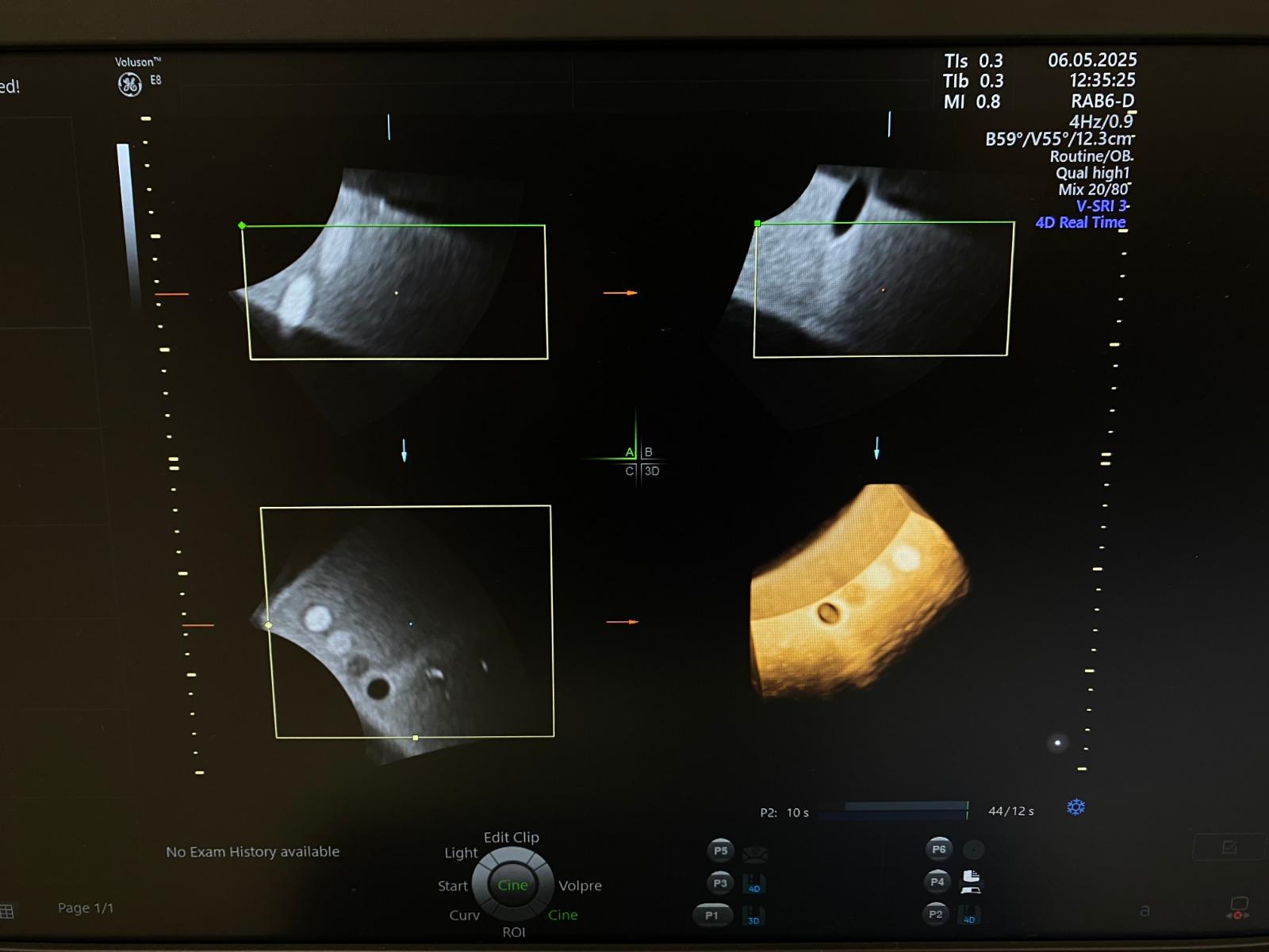 Voluson E8 RAB6-D Probe Label