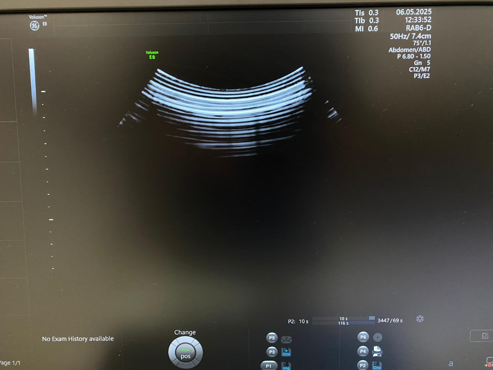 Voluson E8 RAB6-D Probe