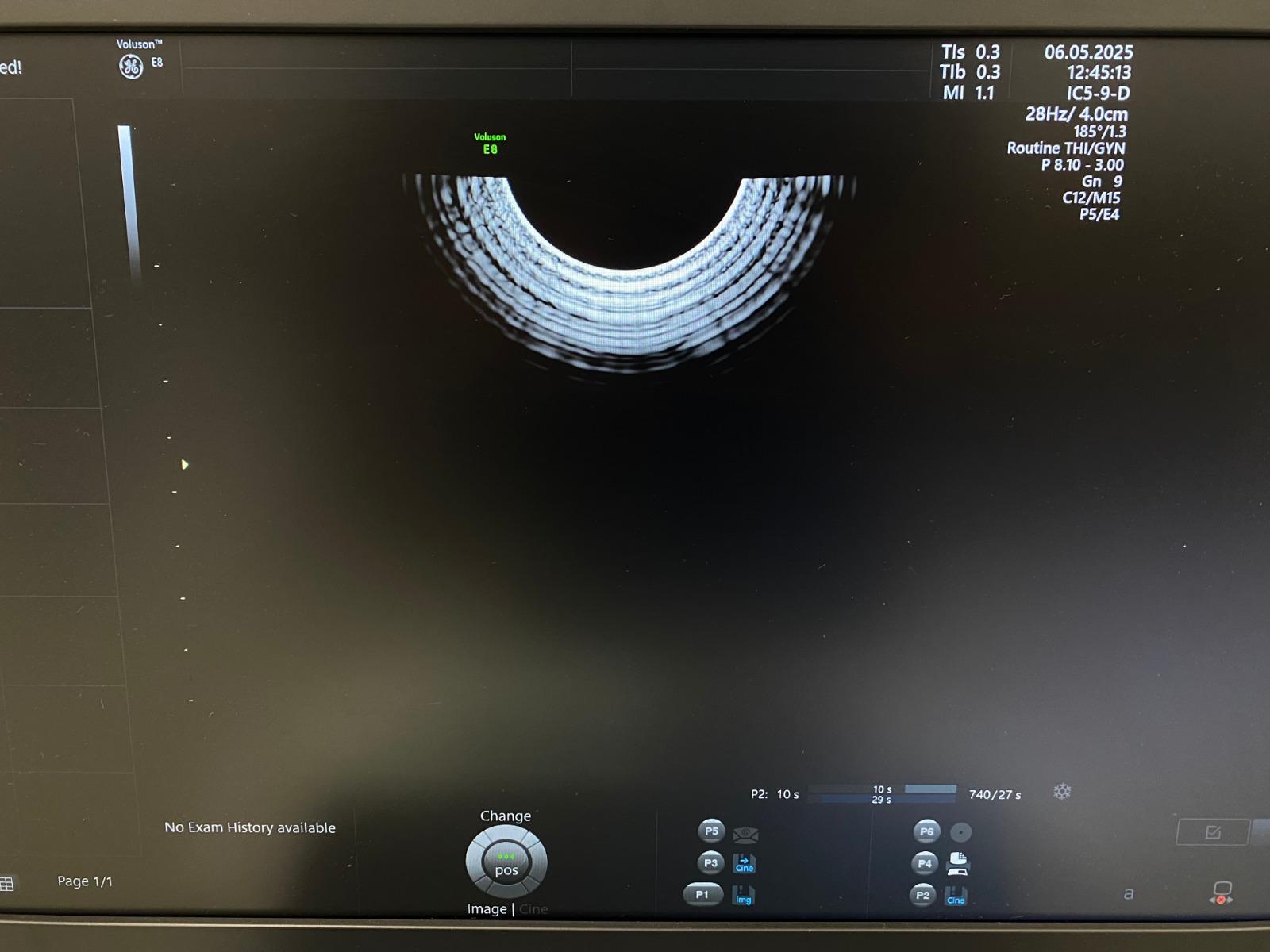 Voluson E8 System Info Screen